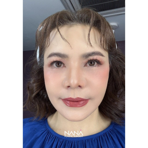 481596730 18269266510248057 8226213081151101119 n