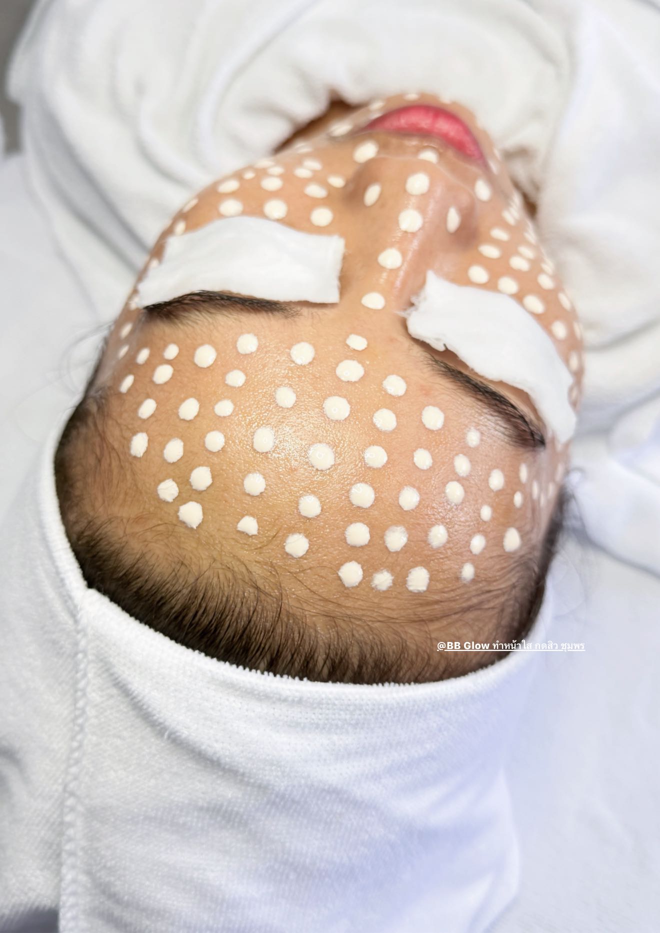 ทำหน้าใส รูขุมขนกระชับ ชุมพร