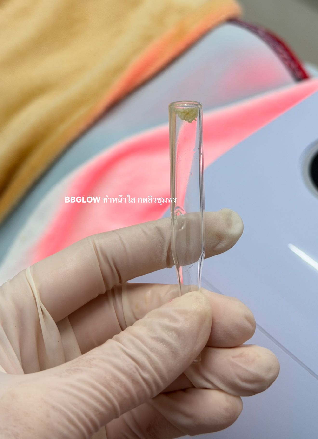 BB Glow โปร 899 ชุมพร ครบ 11 ขั้นตอน