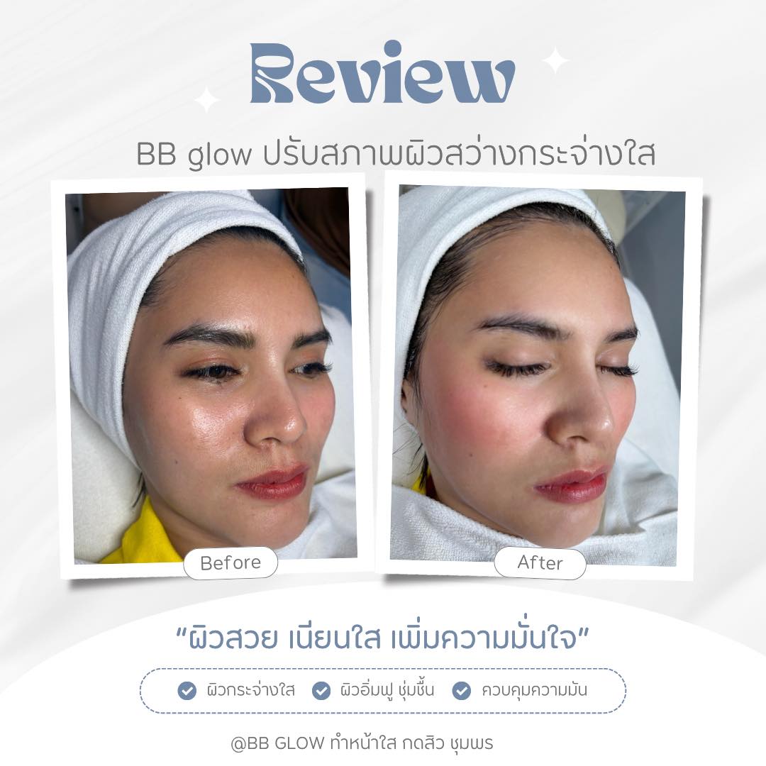 ทำหน้าใส ร้านบิวตี้นุ่มละมุน ชุมพร