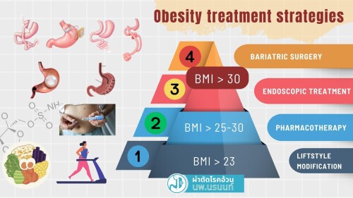 BMI