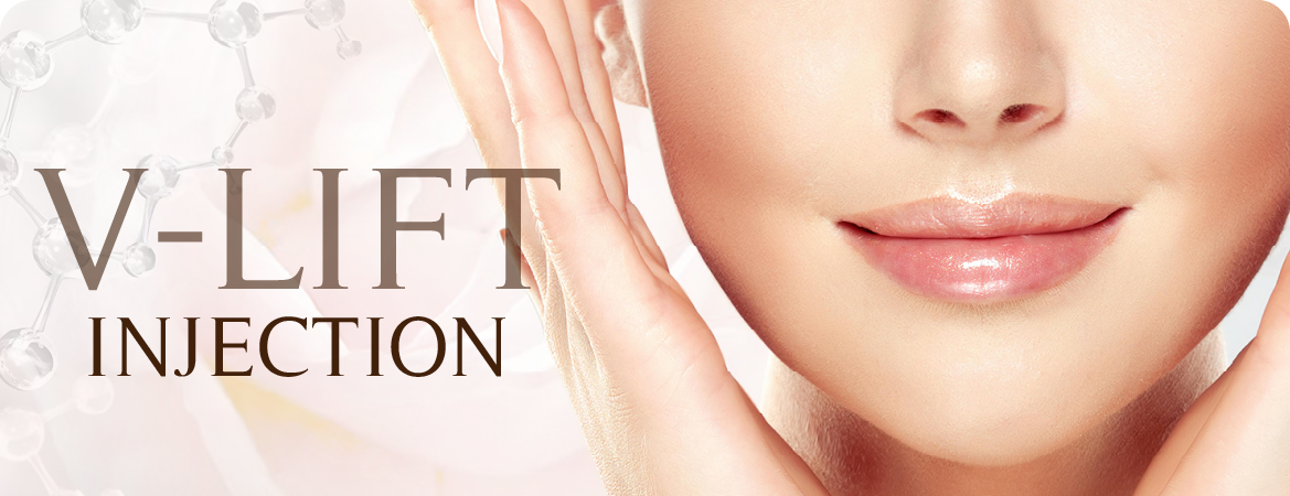 V-Lift Injection