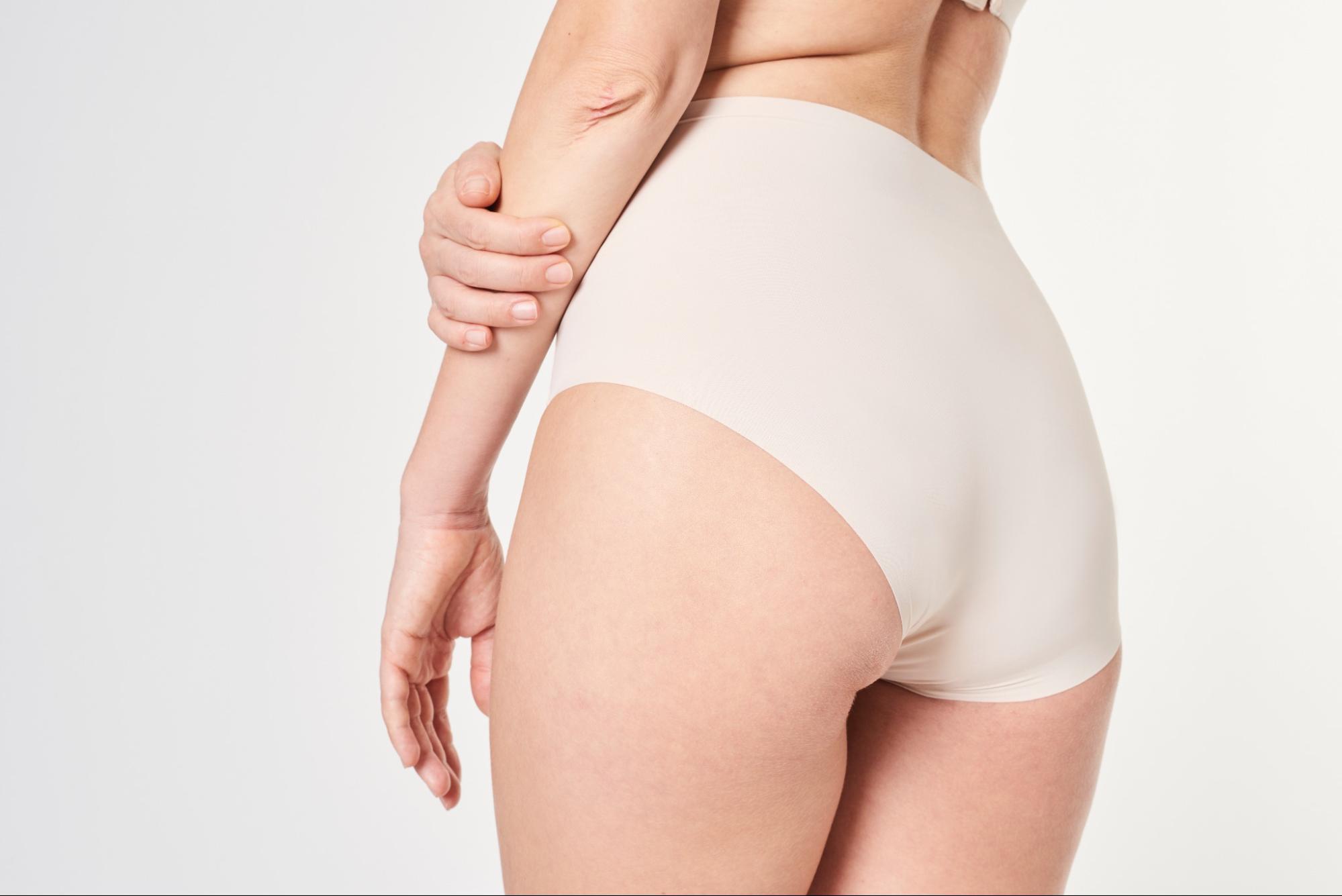 ประเภทสิวที่ก้น