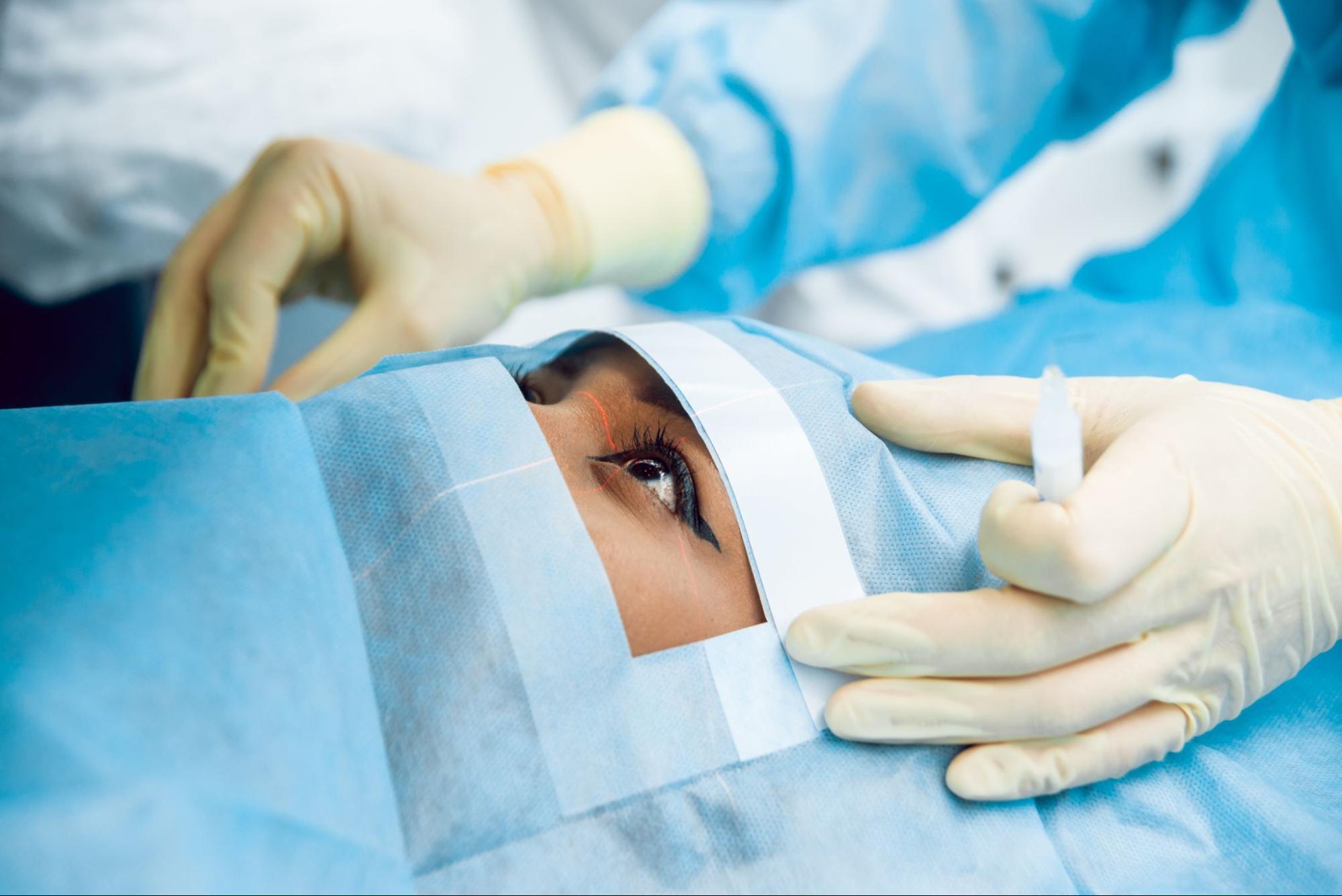 icl surgery คือ