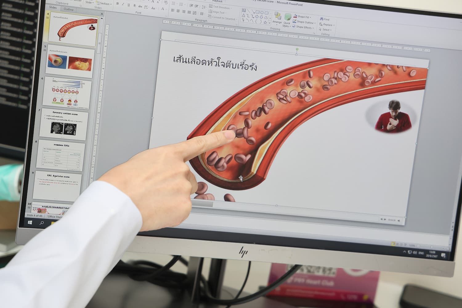 รูปภาพ