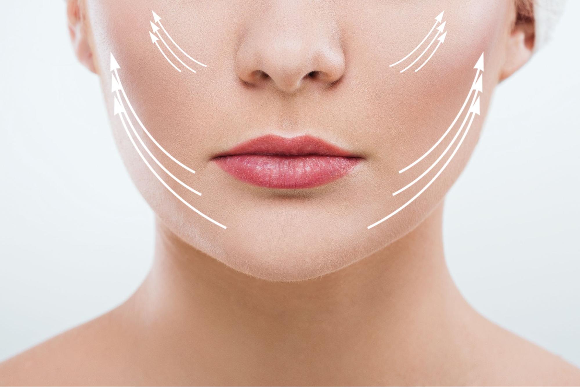 ultraformer mpt ราคา