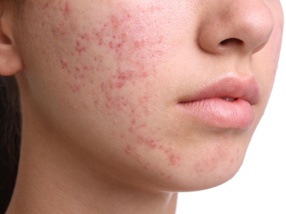 ����Դ�ҡ����